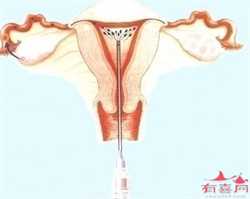 武汉滨哪里有助孕_助孕代怀孕哪家好_专业助孕机构