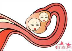 武汉代孕公司_代孕最佳年龄_代孕哪家安全