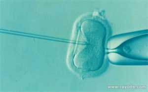 武汉代孕付费是否合法-代孕产子成功率大_美国试管婴儿专家教您避免IVF失败的