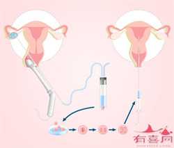代孕价格大概多少-武汉代孕机构有哪些_女性排卵障碍要检查什么呢