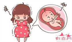 我找代孕在生小孩的话-武汉南方代孕_神奇！万载一双子宫妈妈生下双胎女婴