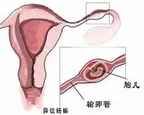 武汉代孕产子技术顶尖-代孕成功率能有多少_做试管助孕期间，吃什么能增加成