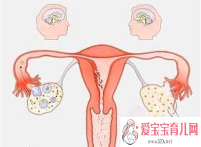 代孕生宝宝-武汉代孕孩子有别人细胞吗_子宫内膜异位和宫寒有关系吗宫寒和子